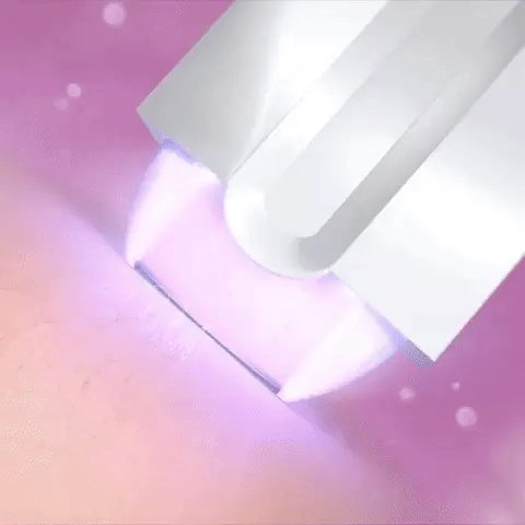 Depiladora Laser - Elimina el vello de raiz & cuida tu piel